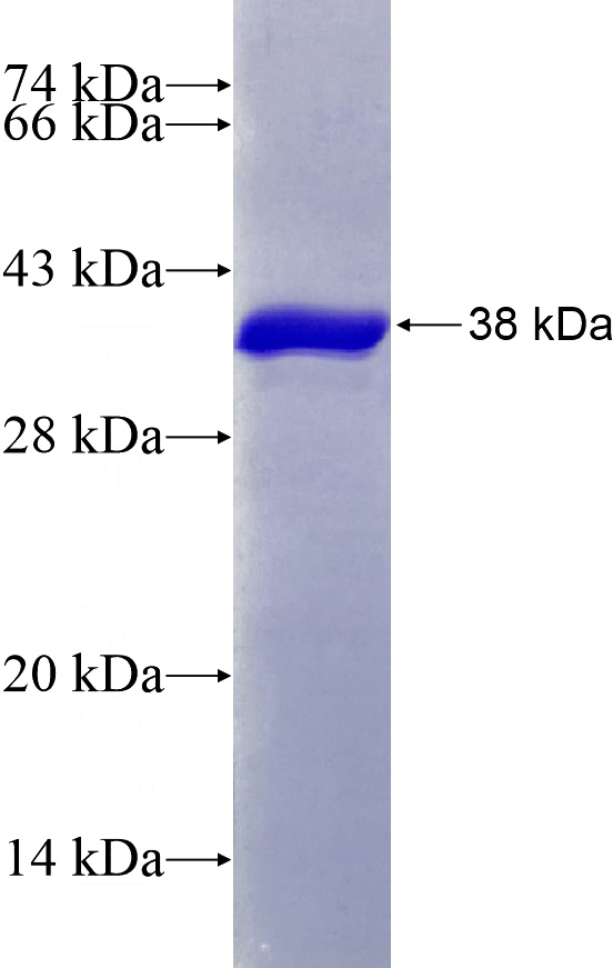 Recombinant Human ZC3H13 SDS-PAGE