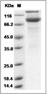 Rat CD131 / CSF2RB / IL3RB / IL5RB Protein (Fc Tag) SDS-PAGE