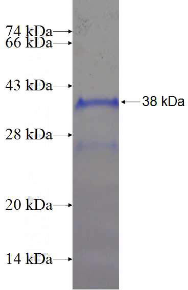 Recombinant Human LYRM7 SDS-PAGE