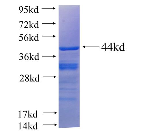 Recombinant human C12orf11 SDS-PAGE