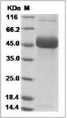 Dengue virus (DENV) (type 2, strain New Guinea C) NS1 Protein (His Tag)