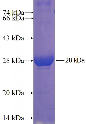 Recombinant Human HKDC1 SDS-PAGE