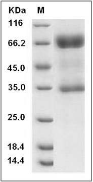 Rat IL2RG / CD132 Protein (Fc Tag) SDS-PAGE
