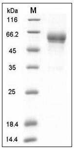 Mouse Coagulation Factor VII / FVII / F7 Protein (His Tag) SDS-PAGE