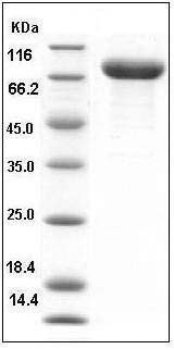 Human IL1R2 / CD121b Protein (Fc Tag) SDS-PAGE