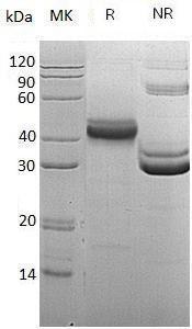 Human CD5L/API6/UNQ203/PRO229 (His tag) recombinant protein
