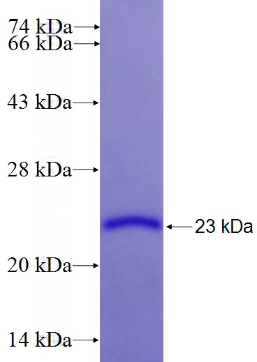 Recombinant Human SLIT1 SDS-PAGE