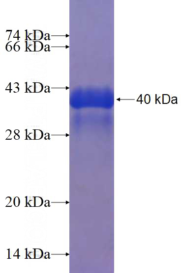 Recombinant Human PPP1R11 SDS-PAGE