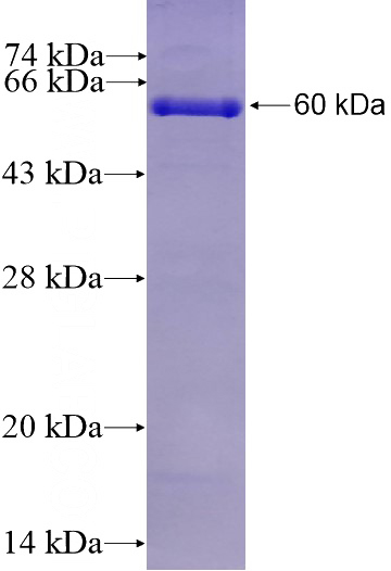 Recombinant Human SRM SDS-PAGE