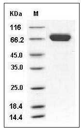 Mouse EphA7 / EHK-3 Protein (His Tag) SDS-PAGE