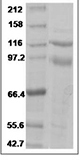 Human ITGA6 & ITGB4 Protein 14961
