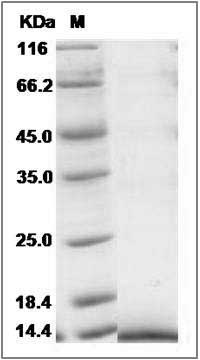 Human CCL27 / CTACK Protein (His Tag) SDS-PAGE