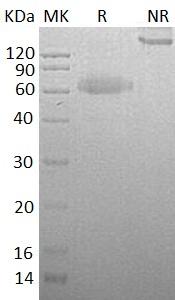 Human RSPO3/PWTSR/THSD2 (Fc & His tag) recombinant protein