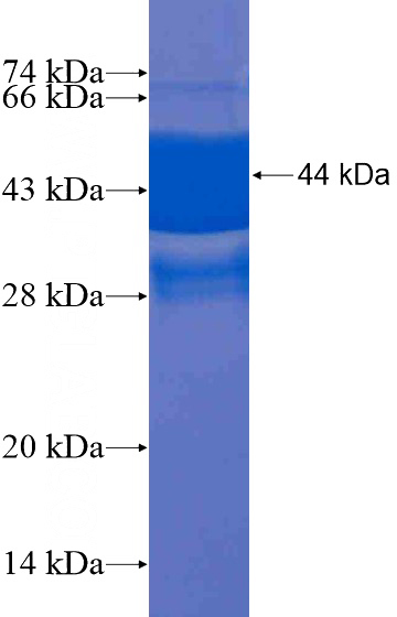 Recombinant Human BCL2L15 SDS-PAGE