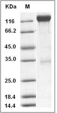 Mouse VEGFR2 / Flk-1 / CD309 / KDR Protein (Fc Tag) SDS-PAGE