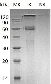 Human CAMK2B/CAM2/CAMK2/CAMKB (His tag) recombinant protein