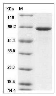 Human GBP1 Protein (His Tag) SDS-PAGE
