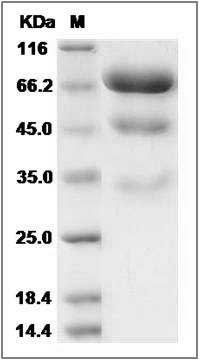 Human PLBD2 Protein (His Tag) SDS-PAGE