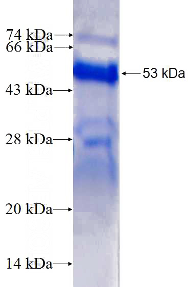 Recombinant Human TP53BP2 SDS-PAGE