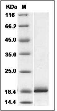 Human VILIP-1 / VSNL1 Protein SDS-PAGE