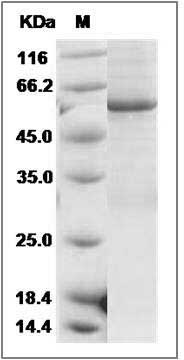 Mouse CDC2 Kinase / CDK1 Protein (His & GST Tag) SDS-PAGE