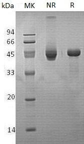Human PPM1A/PPPM1A (His tag) recombinant protein