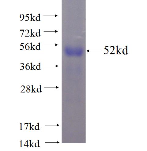 Recombinant human TRAF1 SDS-PAGE