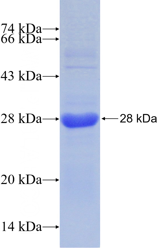 Recombinant Human IL-34 SDS-PAGE