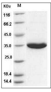 Human KLK3 / PSA / Kallikrein-3 Protein (His Tag) SDS-PAGE