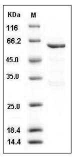 Human MUSK Kinase Protein (aa 433-783, His & GST Tag) SDS-PAGE