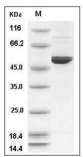 Mouse DOPA Decarboxylase / DDC Protein (His Tag) SDS-PAGE