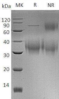 Human CD47/MER6 (His tag) recombinant protein