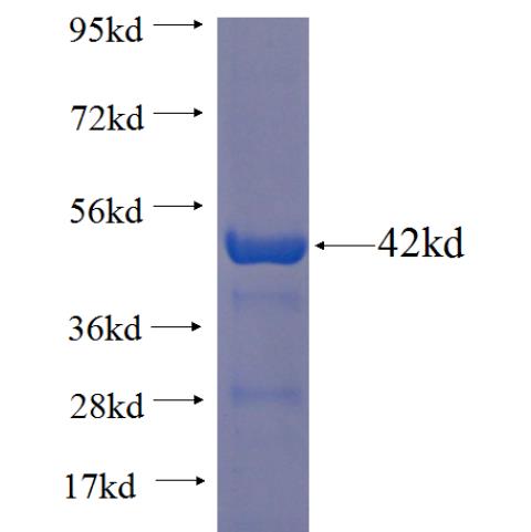 Recombinant Arabidopsis thaliana CeQORH SDS-PAGE