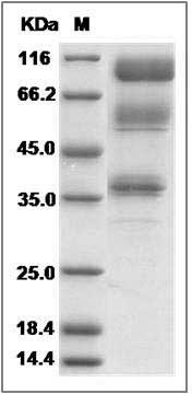 Human IL23R / IL23 Receptor Protein (Fc Tag) SDS-PAGE