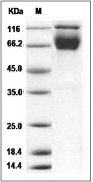 Rat IFNGR / IFNGR1 Protein (Fc Tag) SDS-PAGE