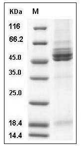 Human RSV (A2) Fusion glycoprotein / RSV-F Protein (His Tag) SDS-PAGE
