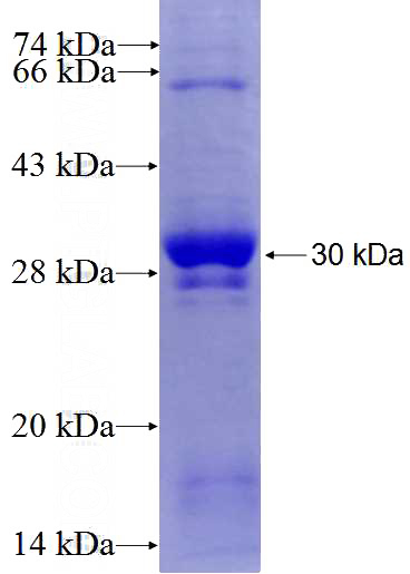 Recombinant Human WDR8 SDS-PAGE