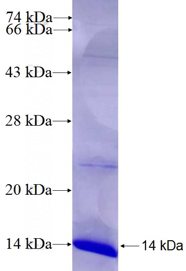 Recombinant Human COX7B2 SDS-PAGE