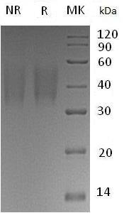 Human TNFRSF10C/DCR1/LIT/TRAILR3 (His tag) recombinant protein
