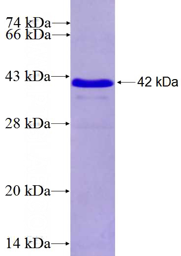 Recombinant Human MLPH SDS-PAGE