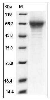 Mouse THSD1 / TMTSP Protein (His Tag) SDS-PAGE