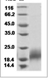 Mouse PDGFB recombinant protein (N-His)