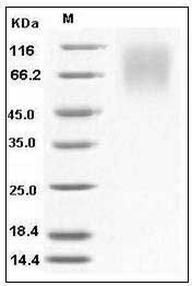 Human LAMP-1/CD107a/LAMP1 (His Tag) recombinant protein
