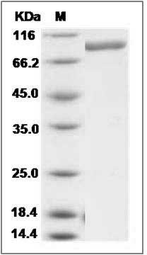 Cynomolgus CLP1 / COLEC12 Protein (His Tag) SDS-PAGE