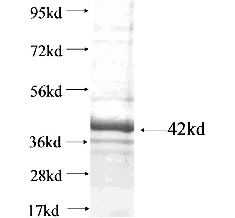 Recombinant human RNF112 SDS-PAGE