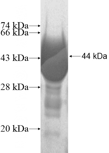 Human UGT1A9 Recombinant protein (6*His tag)