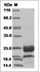 Human GH1 / Growth hormone 1 Protein (His Tag) SDS-PAGE