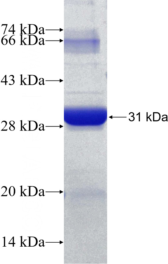 Recombinant Human RPL10A SDS-PAGE