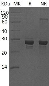 Human CALCB/CALC2 (GST tag) recombinant protein