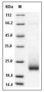 Cynomolgus KIM-1 / TIM1 / HACVR1 Protein (His Tag) SDS-PAGE